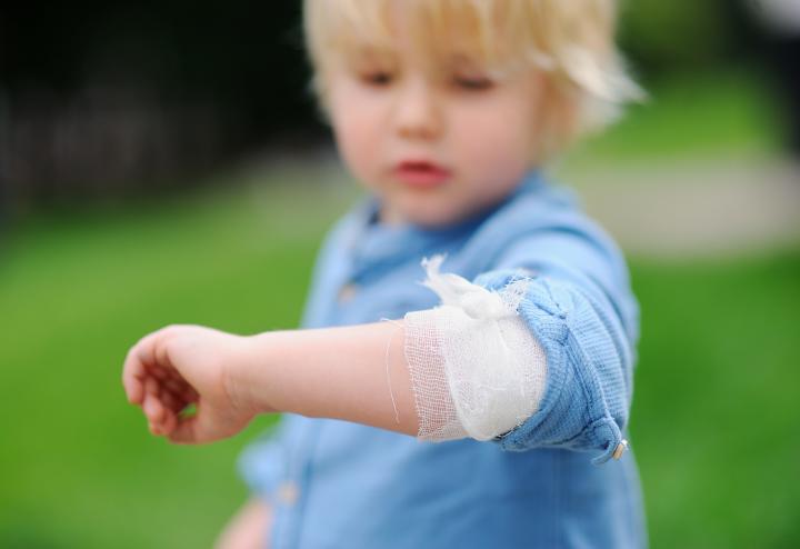 Child with injury on elbow